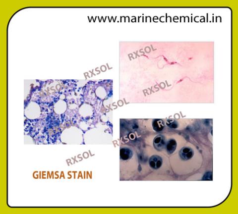 GIEMSA STAIN